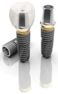 Transfer Abutment Regular D 6,0 x H 4,0 x GH 5,0 Hex