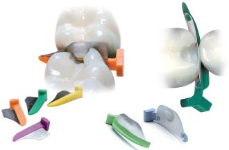 FenderWedge & FenderMate Intro-Kit