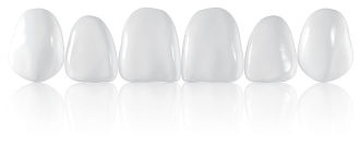 xxxComponeer Upper S 23 – Enamel White Opalescent