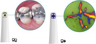 VistaCam iX Cam + Proof